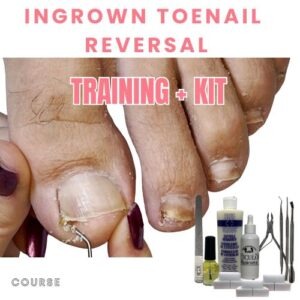 ingrown toenail fix at home